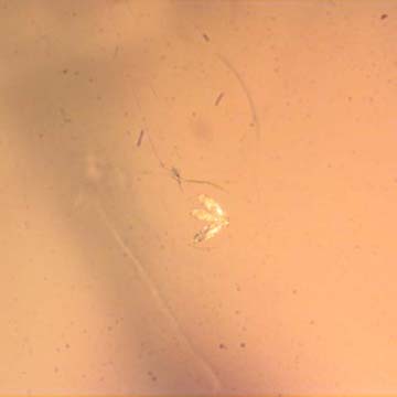Rare Three Eggs, Winged Termite And Cricket In Dominican Amber Rare Three Eggs, Winged Termite And Cricket In Dominican Amber
