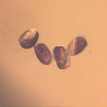 Rare Four Eggs In Dominican Amber Rare Four Eggs In Dominican Amber