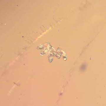 Rare Six Eggs And Fungus Gnat In Dominican Amber Rare Six Eggs And Fungus Gnat In Dominican Amber