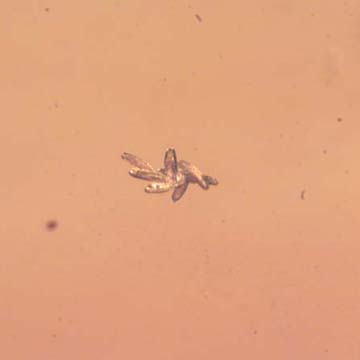 Rare Eight Eggs In Dominican Amber