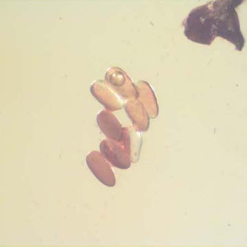 Rare Eight Eggs In Dominican Amber