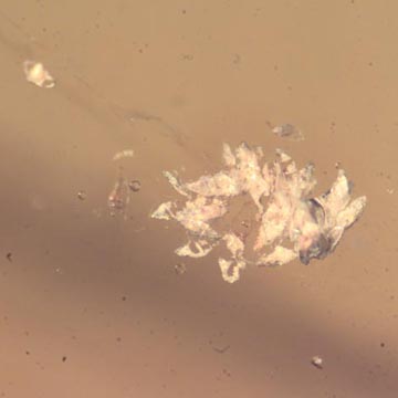 Rare Eggs, Fungus Gnat And Moth Fly In Dominican Amber Rare Eggs, Fungus Gnat And Moth Fly In Dominican Amber