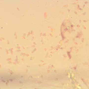 Rare Feather Like Thing And Leafhopper In Dominican Amber Rare Feather Like Thing And Leafhopper In Dominican Amber