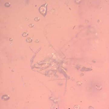 Rare Gnat Bug, Three Fungus Gnats And Scuttle Fly In Dominican Amber Rare Gnat Bug, Three Fungus Gnats And Scuttle Fly In Dominican Amber