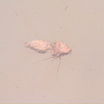 Rare Jumping Plant Lice And Winged Termite In Dominican Amber Rare Jumping Plant Lice And Winged Termite In Dominican Amber