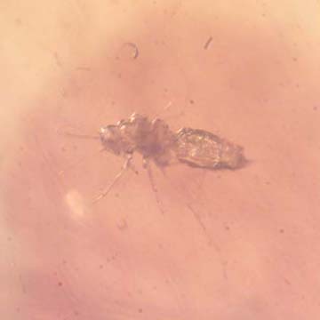Rare Jumping Plant Lice In Dominican Amber Rare Jumping Plant Lice In Dominican Amber
