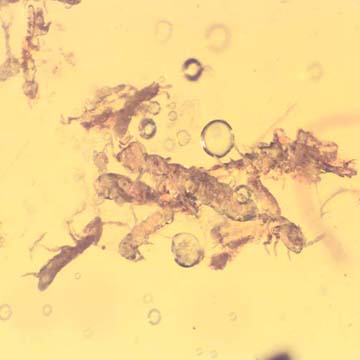 Rare Swarm Of Elongate Springtail And Flower Bud In Dominican Amber Rare Swarm Of Elongate Springtail And Flower Bud In Dominican Amber