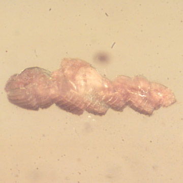 Rare Swarm Of Immature Isopod In Dominican Amber Rare Swarm Of Immature Isopod In Dominican Amber