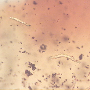 Rare Swarm Of Larva In Dominican Amber.