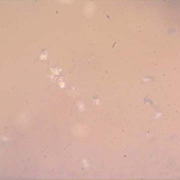 Rare Swarm Of Mite In Dominican Amber.
