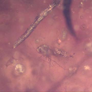 Rare Jumping Plant Lice And Two Flower Stamen In Dominican Amber Rare Jumping Plant Lice And Two Flower Stamen In Dominican Amber