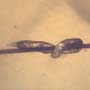 Rare Two Eggs Clinging On A Part Of A Bug In Dominican Amber