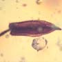 Rare 2 Unusual Flower Bud In Dominican Amber