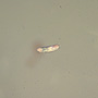 Rare Three Eggs In Dominican Amber