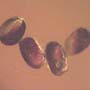 Rare Four Eggs In Dominican Amber