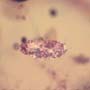 Rare Four Isopods In Dominican Amber
