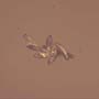 Rare Eight Eggs In Dominican Amber