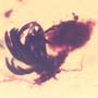 Rare Botanical With Roots And Fungus Gnat In Dominican Amber