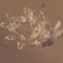 Rare Eggs, Fungus Gnat And Moth Fly In Dominican Amber
