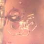 Rare Fungus Gnat With Twenty Eggs, Spider And Four Elongate Springtail In Dominican Amber