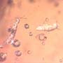 Rare Fungus Gnat With Twenty Eggs, Spider And Four Elongate Springtail In Dominican Amber