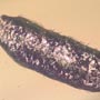 Rare Gall Gnat Coming Out Fiberous Seed In Dominican Amber