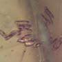 Rare Sixteen Eggs In Dominican Amber