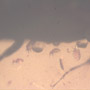Rare Thirty Six Mites Clinging On Bark Beetle In Dominican Amber