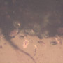 Rare Thirty Six Mites Clinging On Bark Beetle In Dominican Amber