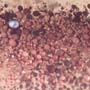 Rare Four Beetle, Fungus Gnat, Bark Beetle And Nice Bubble Formation In Dominican Amber