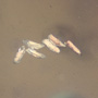 Common Six Eggs In Dominican Amber
