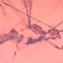 Rare Assassin Bug In Dominican Amber