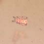 Rare Beetle Larva With Mite On Top, Cool Bubble On Its Mouth And Two Mites In Dominican Amber