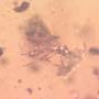 Rare Gnat Bug, Black Scavenger Fly And Male Ant In Dominican Amber