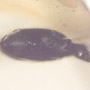 Rare Head Of Bug With Huge Mandibles In Dominican Amber