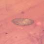 Rare Jumping Plant Lice And Larva In Dominican Amber