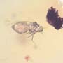 Rare Jumping Plant Lice In Dominican Amber