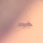 Rare Jumping Plant Lice In Dominican Amber