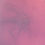 Rare Jumping Plant Lice In Dominican Amber