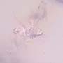 Rare Jumping Plant Lice In Dominican Amber
