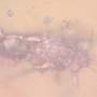 Rare Jumping Plant Lice In Dominican Amber