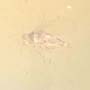 Rare Jumping Plant Lice In Dominican Amber