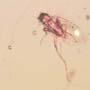 Rare Lots Of Mite, Fungus Gnat, 2 Pomace Flies, Scuttel Fly, Snipe Fly, Scelionid Wasp, 3 Gall Midges, Biting Midge And Botanical In Dominican Amber