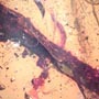 Rare Microcosm, Dicotyledon, Very Large Stem, Scelionid Wasp, Two Plant Bugs, Leafhopper, Elongate Springtail And Leaf In Dominican Amber