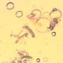 Rare Swarm Of Elongate Springtail And Flower Bud In Dominican Amber