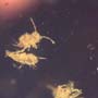 Common Swarm Of Elongate Springtail In Dominican Amber