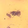 Common Swarm Of Elongate Springtail In Dominican Amber