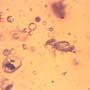 Common Swarm Of Elongate Springtail In Dominican Amber