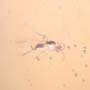 Rare Swarm Of Gall Midges, Barklouse And Beetle In Dominican Amber.