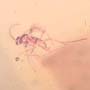 Rare Swarm Of Gall Midges, Barklouse And Beetle In Dominican Amber.